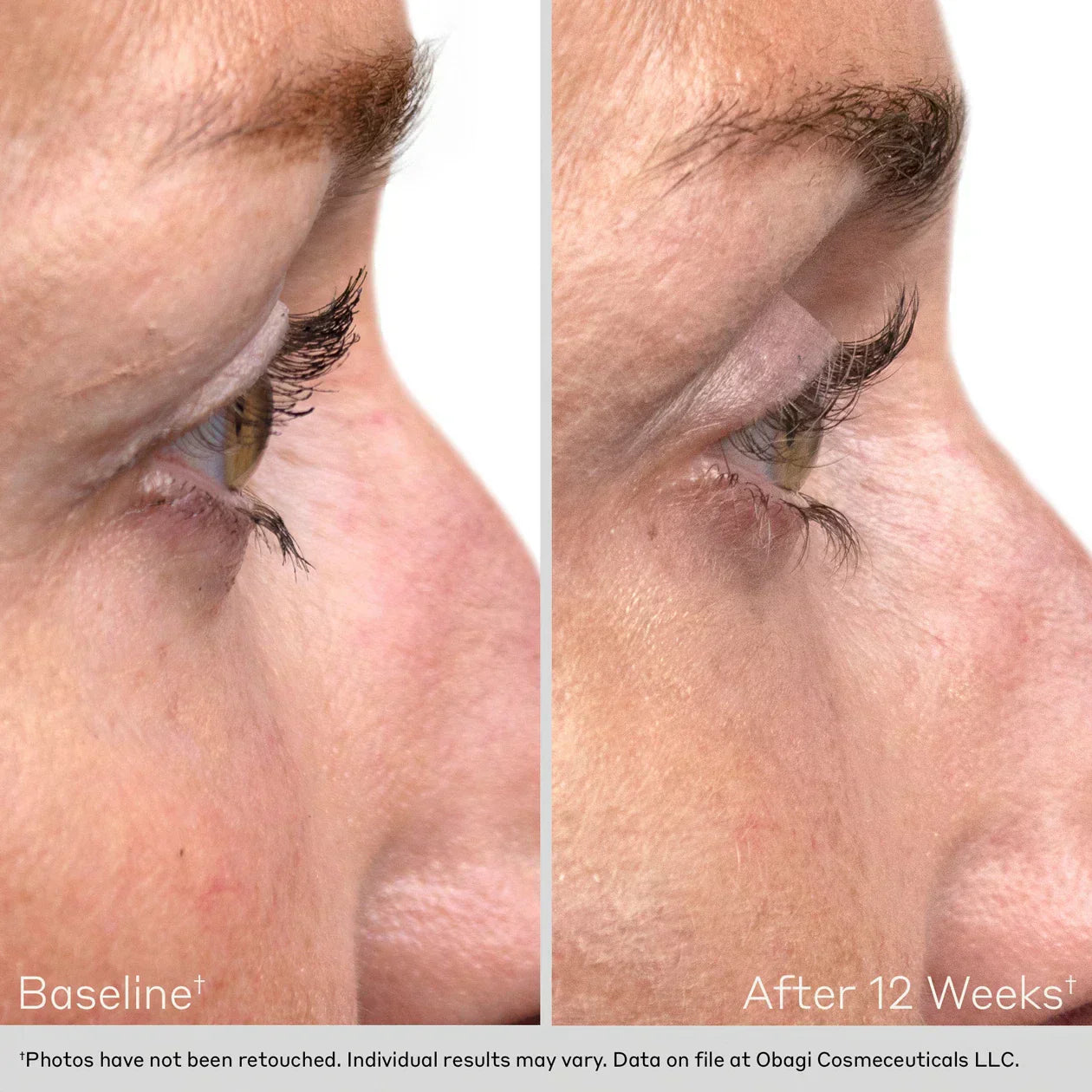 Eyelash Enhancing Serum