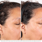 Nu-Cil Biostim Scalp Serum