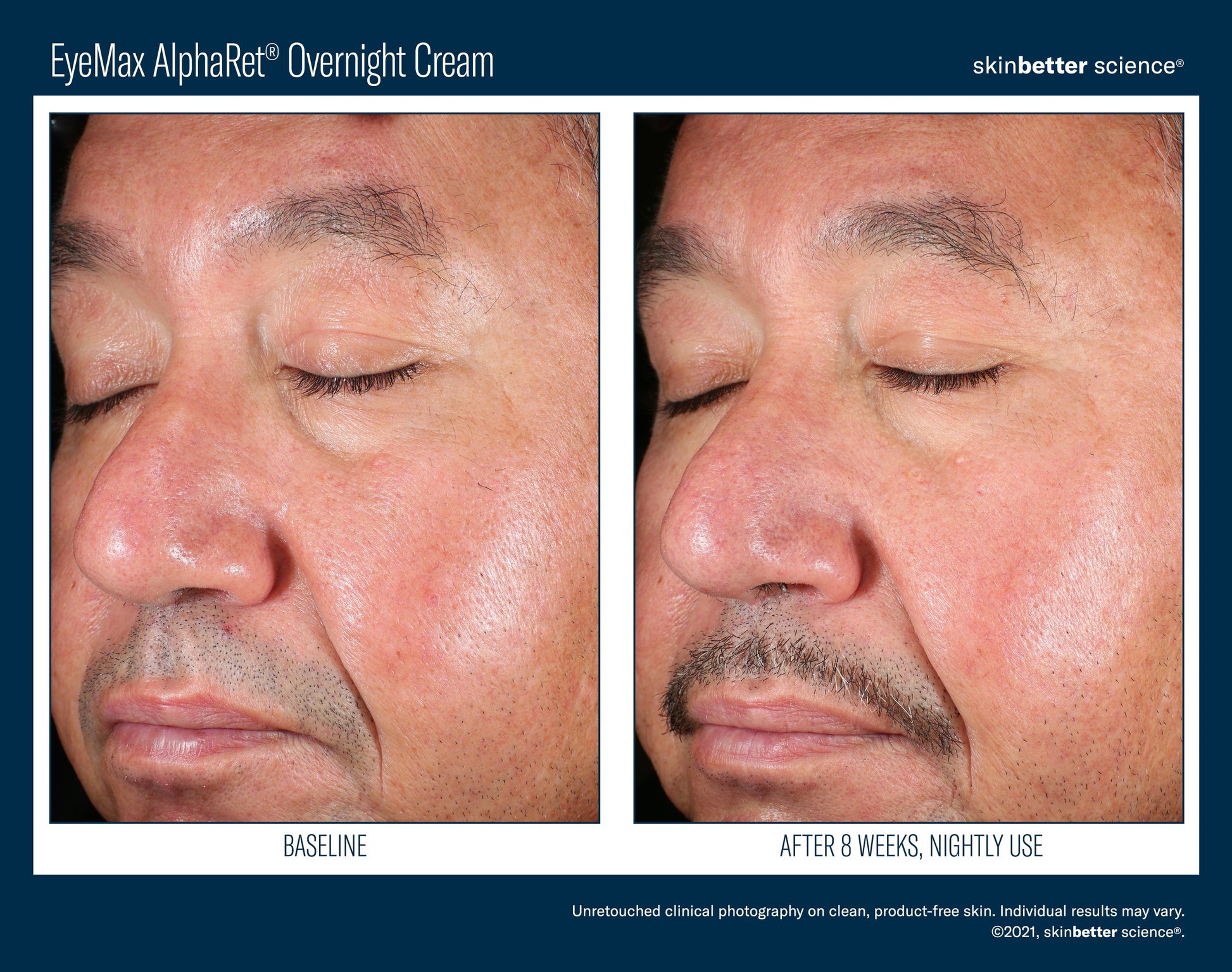 EyeMax AlphaRet Overnight Cream 15 ml