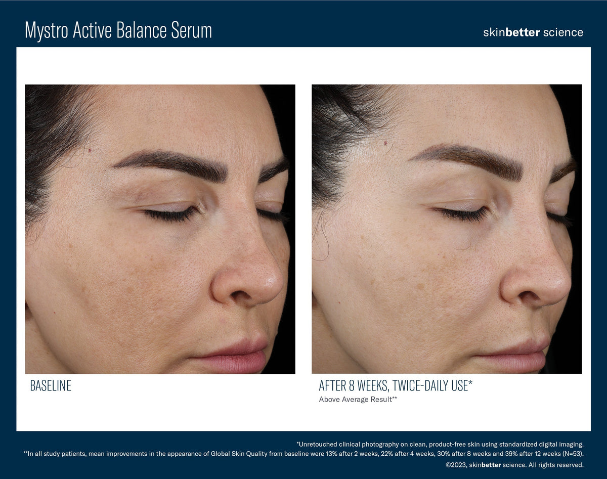 Mystro Active Balance Serum 30 ml