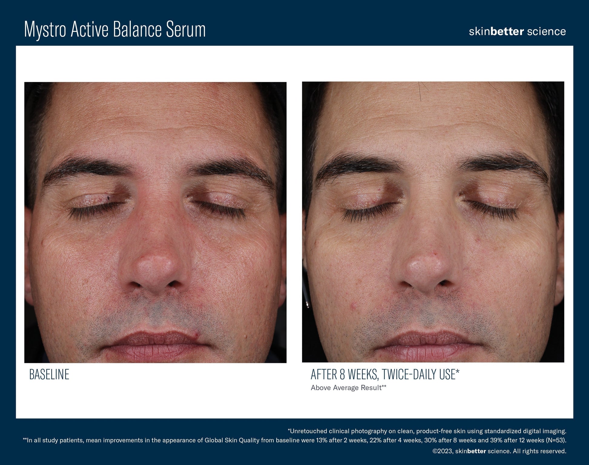 Mystro Active Balance Serum 50 ml