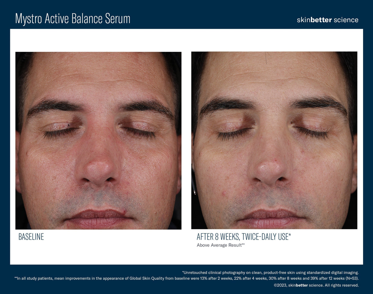 Mystro Active Balance Serum 50 ml