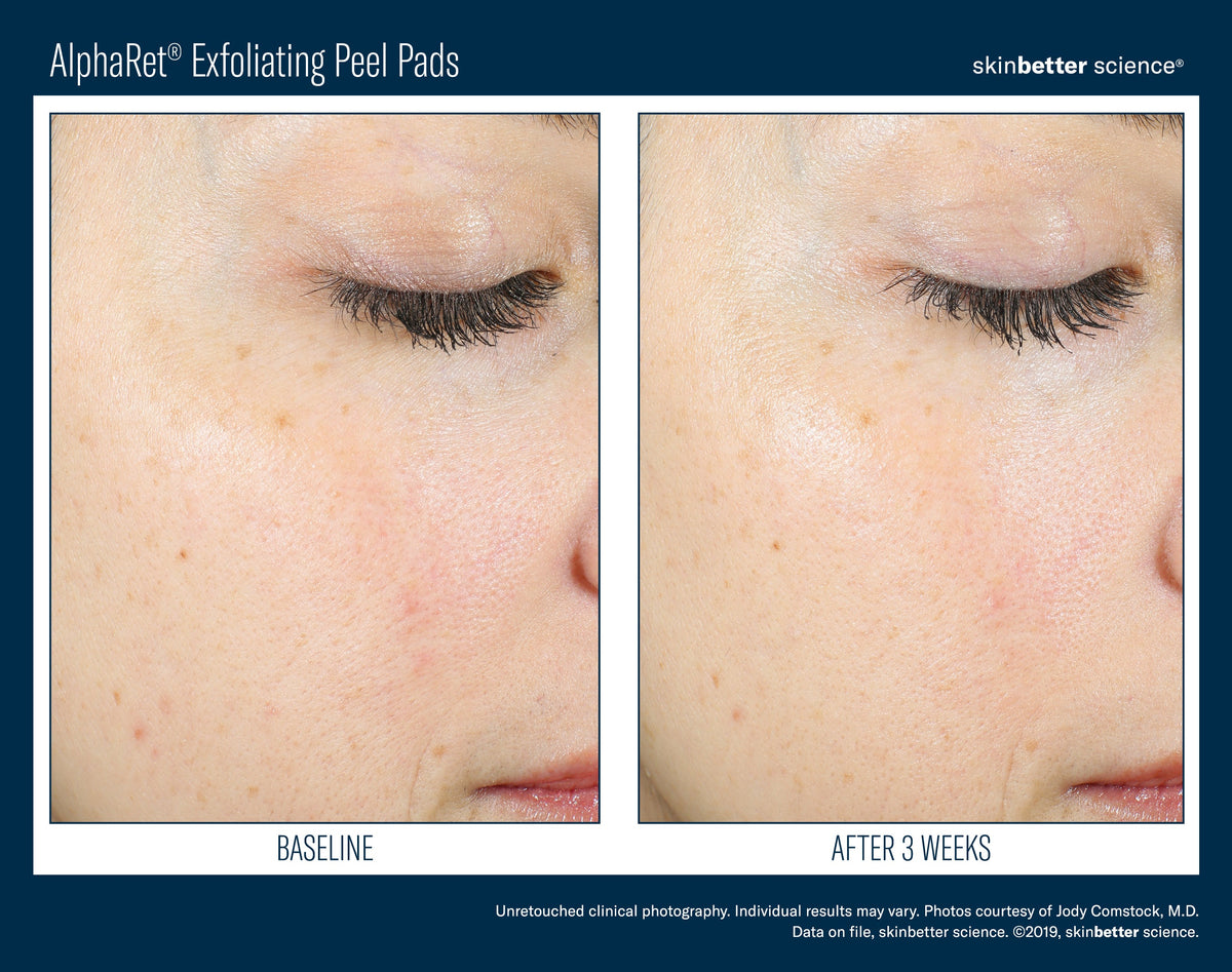 AlphaRet Exfoliating Peel Pads 30 ct