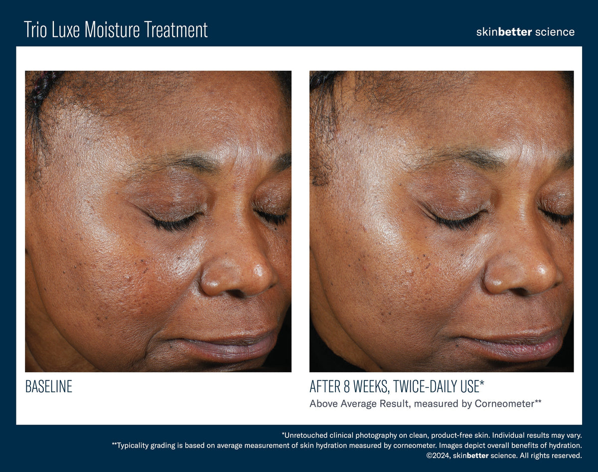 Trio Luxe Moisture Treatment 50 ml